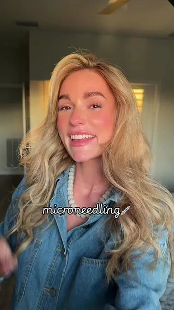 Another round of DIY microneedling and the results are 😚🤌🏼 #microneedling #microneedlingtherapy #microneedlingbeforeandafter #nurselife #nursetok  