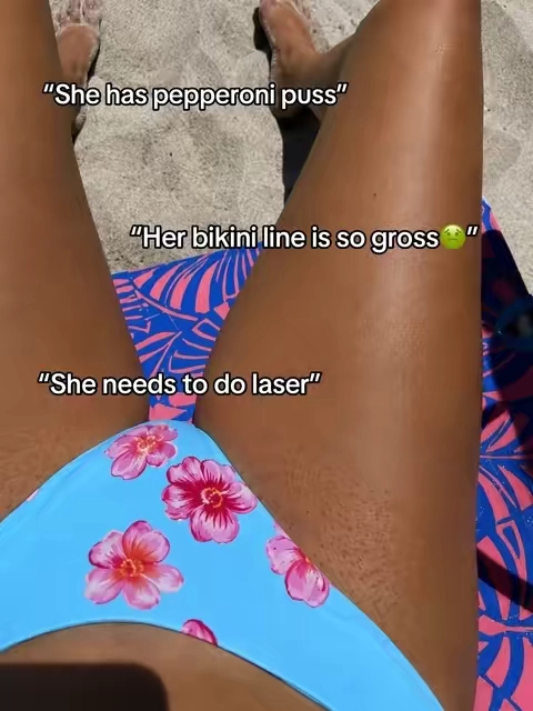 finally confident #GlowUp #hairremoval