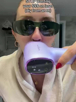 at home med spa results with wavytalk #laserhairremoval #DIY #wavytalk #smoothskin 