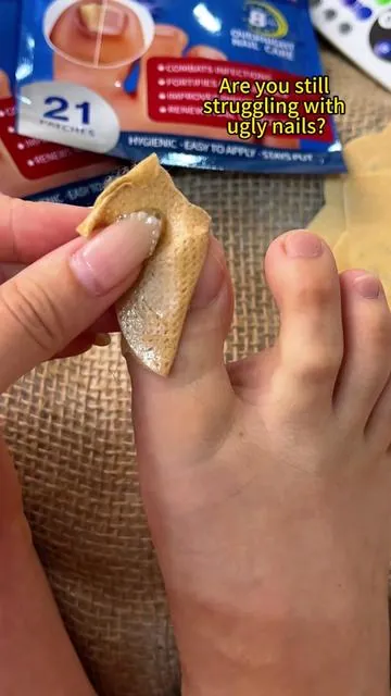 "Funky nails? Not anymore. These patches are SAVING toes 🔥👍#NailTok#FootCare#FungalNails#NailFix#BeforeAndAfter