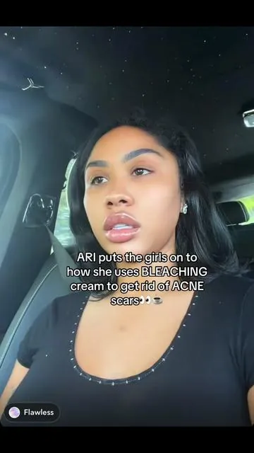 ARI puts the girls on to how she uses BLEACHING cream to get rid of ACNE scars👀☕️ #ari #bleachingcream #acne #fyp #viral 