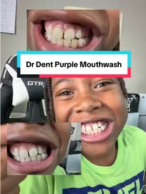 Everyone needs purple mouthwash🤯 #drdent #teethwhitening #yellowteeth