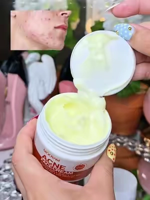 MOOYAM Acne Scar Treatment Cream 50ml Centella & Snail Repair Cream Post-Acne Marks Removal Acne&Pimple Treatment Fragrance Free Paraben Free Skincare Salicylic Skin Repair Sensitive Teens Scent free skincare Healthcare Aroma Therapeutic pimplepatches