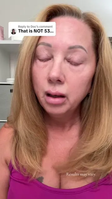Replying to @Doc do you think I like looking older? #wrinkles #antiaging #eyebags #instantfacelift #tiktokshopcreatorpicks @Peter Thomas Roth Labs 