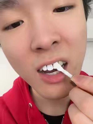 The difference is crazy ngl!! #teethwhitening #hismile 