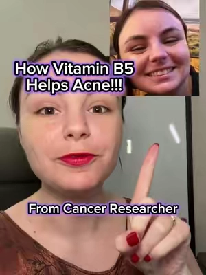 Vitamin b5, or Pantothenic acid, is phenomenal for skin health in a few key ways! #vitaminb5 #pantothenicacid #skincare #oilyskin #acneproneskin 