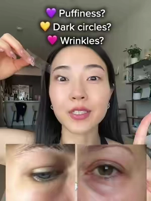 NEW eye cream trio, one for each concern— dark circles, puffiness, and wrinkles! #biodance #eyebags #darkcircles #antiaging #tiktokshopcreatorpicks @Biodance Store US 