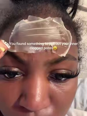 The best shi TikTok could’ve invented 😩 #fyp #viral #skincareroutine 