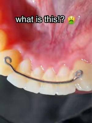 The buildup 😭 #gaptaincrunch #fyp #teethwhitening #viral #ad 