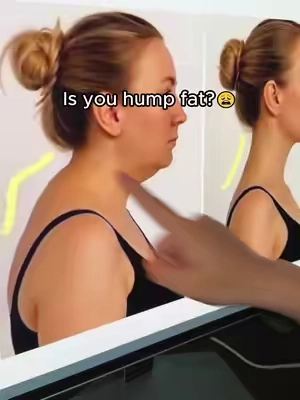 This might be the greatest invention for backs — jelly bra that corrects posture 🤯 Don't miss out #tiktokmademebuyit #posturebra #posturecorrection #backpainrelief #shoulderpain