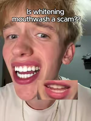Insane results, comment questions #dealsforyoudays #bodyaccel #purplemouthwash #resultsmayvary #whiterteeth 