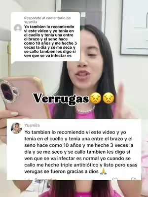 Respuesta a @Yusmila #verrugas #parati 