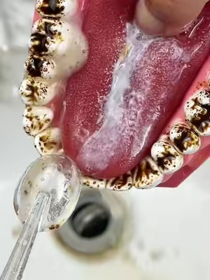 #clean #capcut #tiktok #tiktokshop #teeth 