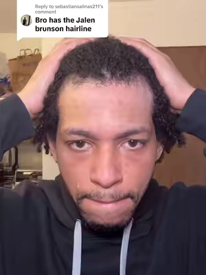 Replying to @sebastiansalinas211 went from Jalen Brunson to Sir cruise type of hairline.  I did it by taking this one pill that has 4 DHT blocking herbs in it.  #f#fypv#viralb#baldingh#hairlossr#recedinghairline