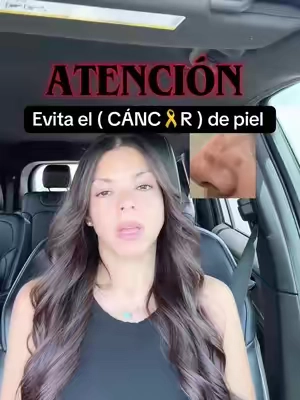 Respuesta a @mariaporrasbedrel #sol#piel#skin#cuidadodelapiel#protection