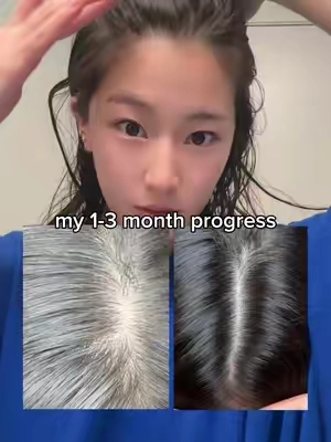 my haircare routine for hair growth! @VT Cosmetics US #vtcosmetics #hairtok #hairgrowth #scalpcare #koreanhaircare 