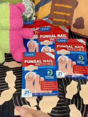 Si te avergüenza mostrar tus pies, mira esto 🥹🦶 #UñasDeLosPies #FootCare #NailCare #DealsForYouDays 