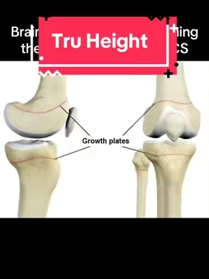 Send this to a short king #sports #athleticperformance #height #shortkings #minipekka 