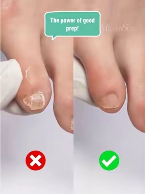 The power of good prep! Make toes feel fresh with this PC90G nail drill! 👉🏻Check my shop! #melodysusie #pedicure #toenail #nailprep #nail 