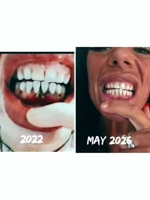 7666114877353708830