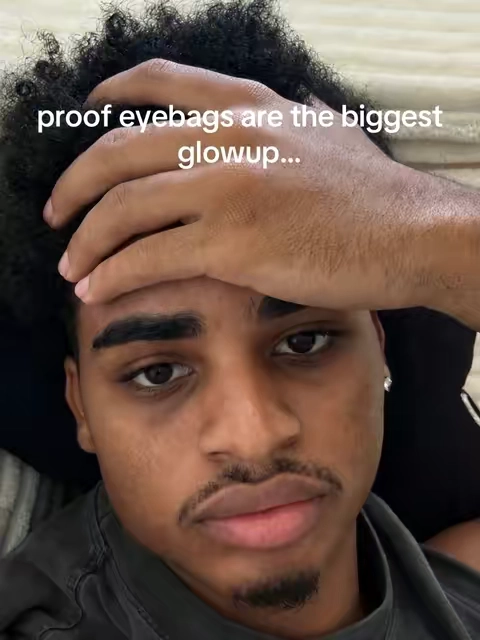 this fixed my eyebags