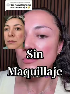 Replying to @Ellie grand alla Quien lo quiera creer 🤷🏻‍♀️ tu carita te lo Va a agradeces #colagenoparalasmujeres #arrugasfaciales #k2oglowthissummerchallenge #electrolytes #tiktokshopsummersale disclaimer: precios promocione y resultados pueden variar