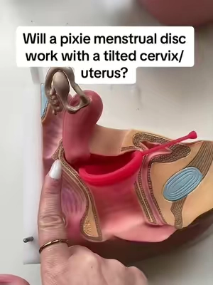 Been seeing this question a lot in the comments, so hopefully this will help you decide on weather to get a cup or a disc. #tiltedcervix #retroverteduterus #tilteduterus #menstrualdisc #menstrualcup 