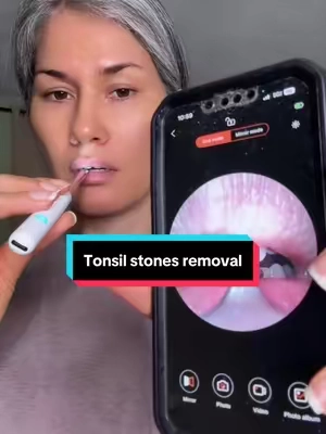 #tiktokshopsummersale #summerfinds #tonsilstonesremoval #malaliento 