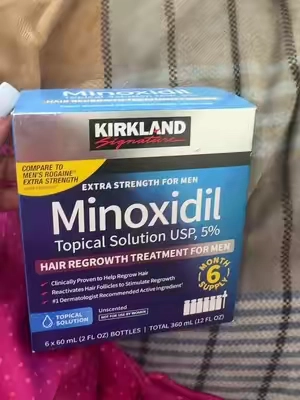 My review on the minoxidil 
