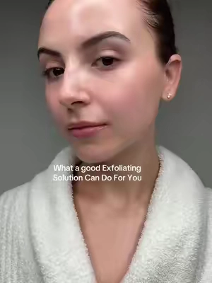 The glow speaks for itself. ✨🤍 I’ve been reaching for the Multi Acid Milk Peel from @prequelskin whenever my skin is looking a little dull. It gently exfoliates to help remove dead skin cells, leaving my skin feeling smoother and looking brighter with a fresh, healthy-looking glow. It’s such an easy step to add to your routine when your skin needs a little refresh. @prequelskin #prequelskin #prequelskinpartner 
