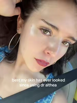 filmed the last clip when i got home but my actual holy grail yall r welcome #dralthea #skincare #acne #fyp 