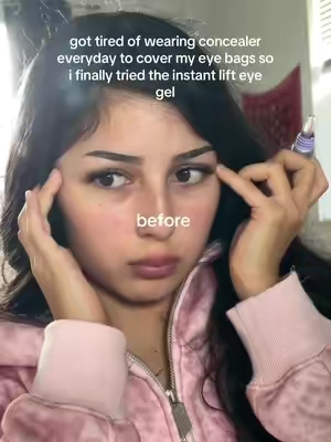 i still can’t tell if they’re eyebags or dark circles.. they prolly both 😒😭 #fypシ #relatable #eyebags #darkcircles #eyecream 