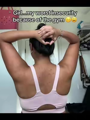 Girl pls don’t judge 🥲#acne #acnetreatment #backacne 