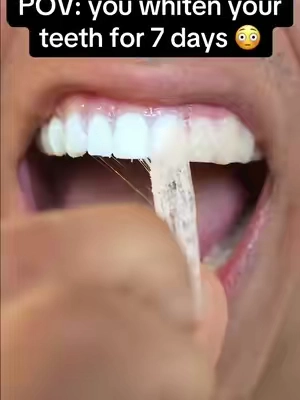 The results after 😳 #gaptaincrunch #fyp #teethwhitening #viral #TikTokShopCreatorPicks 