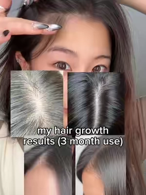 My hair growth hack 🤌 @VT Cosmetics US @vtcosmetics_official #vtcosmetics #scalpcare #hairgrowth #hairtok #koreanhaircare 