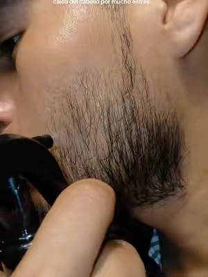 #Minoxidil #barba #barbones #hairgrowthtips 