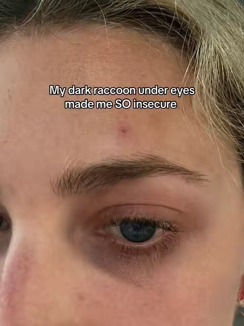 Keep in mind I only wear blush and bronzer this is no conceal just bare under eyes 🤩