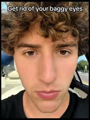 Fix your eyebags with based under eye elixir @BASED 