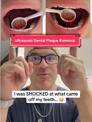 The before-and-after completely surprised me. 🦷 This ultrasonic plaque remover helps tackle stubborn buildup in those hard-to-reach spots and leaves your teeth feeling incredibly clean. It comes with multiple attachments, a dental mirror, and different cleaning modes for an easy at-home clean. #OralCare #TeethCleaning #DentalHygiene #HealthySmile #SelfCareRoutine