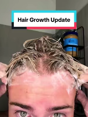 Spoiler: it worked… The new formula is soo good! So much stonger now and more hair growth ingredients!  Disclaimer: results may vary! This is my experience and it could be different than yours. ##hairgrowth##hairgrowthtips##hairgrowthshampoo##shampooreview##revita@@DS Laboratories
