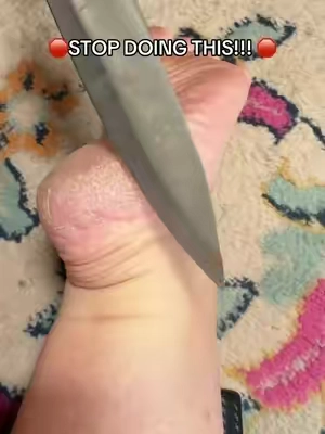 How you’re gonna wear sandals the rest of this summer! #foottok #diypedicure #koreanbeautysecrets 