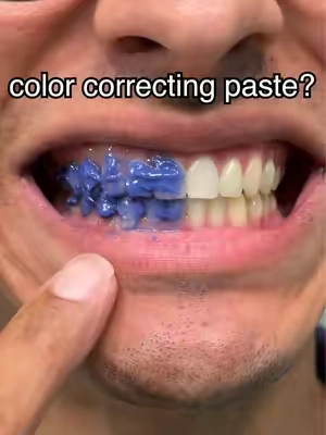 This turns white 🤯 #gaptaincrunch #fyp #teethwhitening #viral #TikTokShopCreatorPicks 