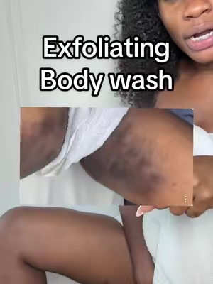 #boils #cyst #bodybreakouts 