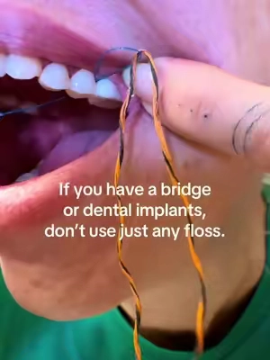 Taking care of dental work starts with the right floss. 🦷✨ #DentalBridge #DentalImplants #OralCare #HealthyGums #DentalFloss 