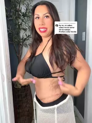 Replying to @Mathybel body makeup! Cover scars, stretch marks, cellulitis, hyperpigmentation, plastic surgery scars! @Westmore Beauty #beauty #tiktokshopcreatorpicks #plasticsurgery #scars #stretchmarks 