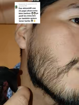 #barba #serum #paratii #minoxidil 