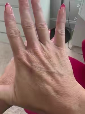 @DRMTLGY #handcream #handlotion #lotion #Wrinkles #antiaging 