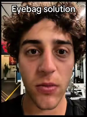 Fix your eyebags with based under eye elixir @BASED 