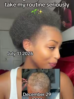 2026 is the year of consistency🌱✨ #naturalhairjourney #twa #bigchop #womenshaircut #type4hair