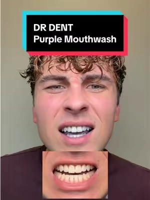 Purple mouthwash from DR. DENT, a 30 second swish that color corrects yellow tones for a whiter looking smile. Easiest step in my teeth whitening routine. #mouthwash #purplemouthwash #drdent #teethwhitening #whiteteeth 